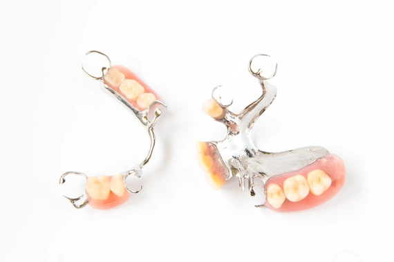 Metal framework partial dental dentures
